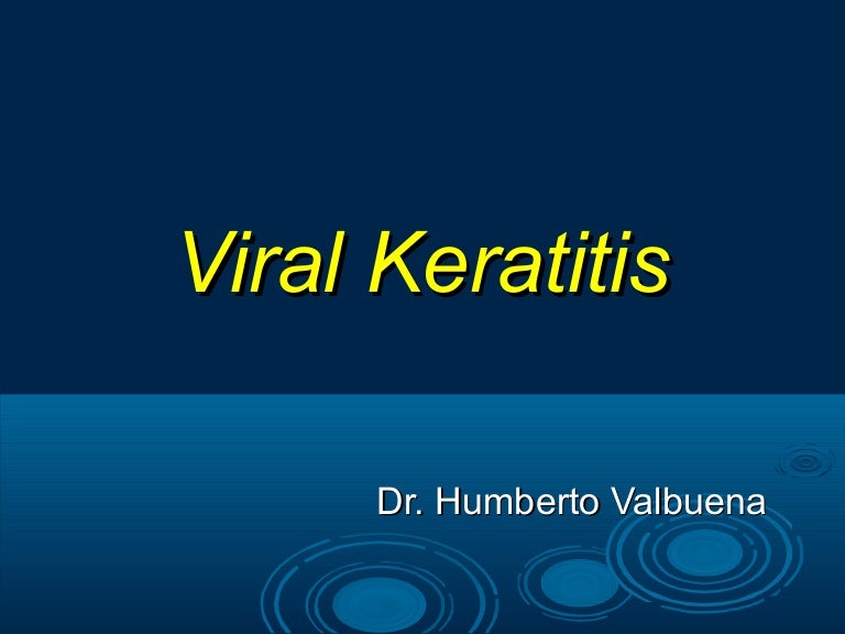 Keratitis Viral