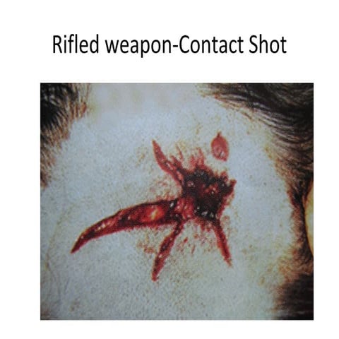 23 f wound balistics 23