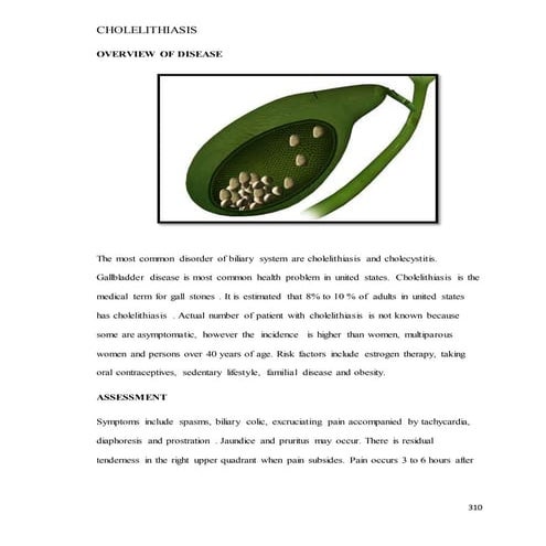 Cholelithiasis NCM 103