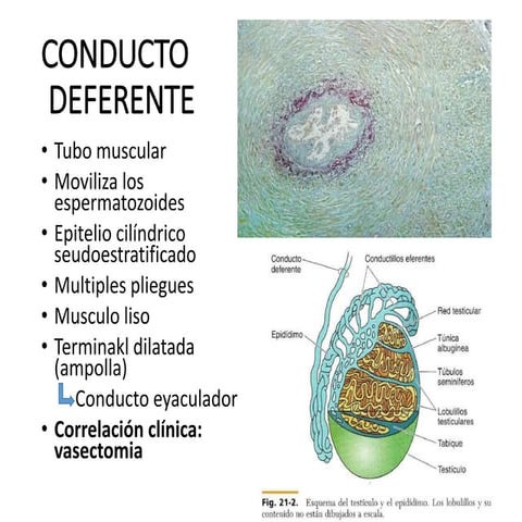 conductos deferente y eyaculador | PPTX