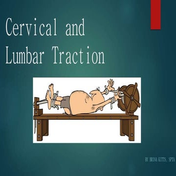 Cervical and Lumbar Traction