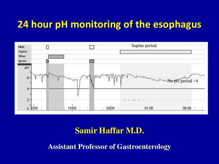 pH monitoring of the esophagus