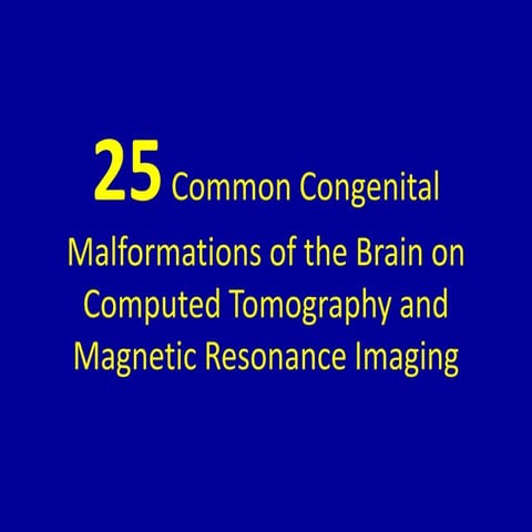 25 common congenital malformations of the brain on