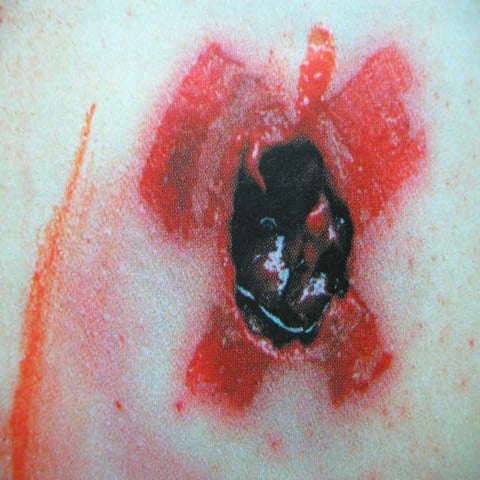 25 f wound balistics 25a1