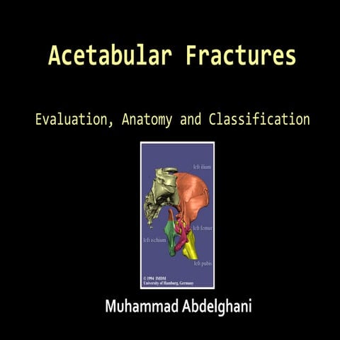 26. acetabular fractures   anatomy, evaluation and classification  - muhammad...
