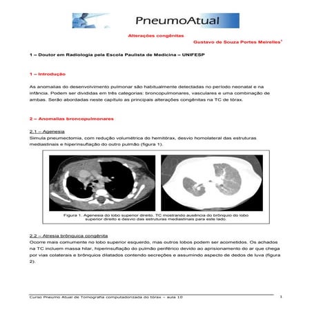 Aula 1 - tomografia de tórax de alta resolução | PDF