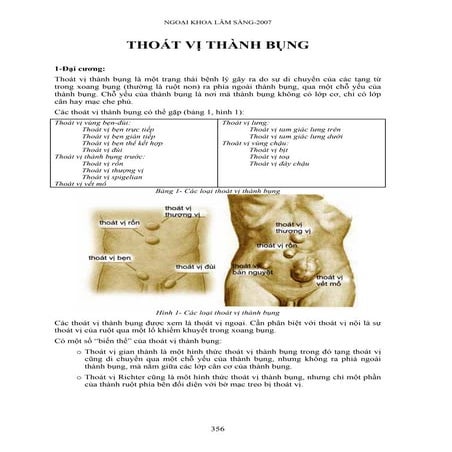 Thoát vị thành bụng
