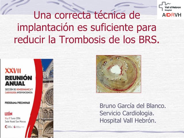 Una correcta técnica de implantación es suficiente para reducir la Trombosis ...