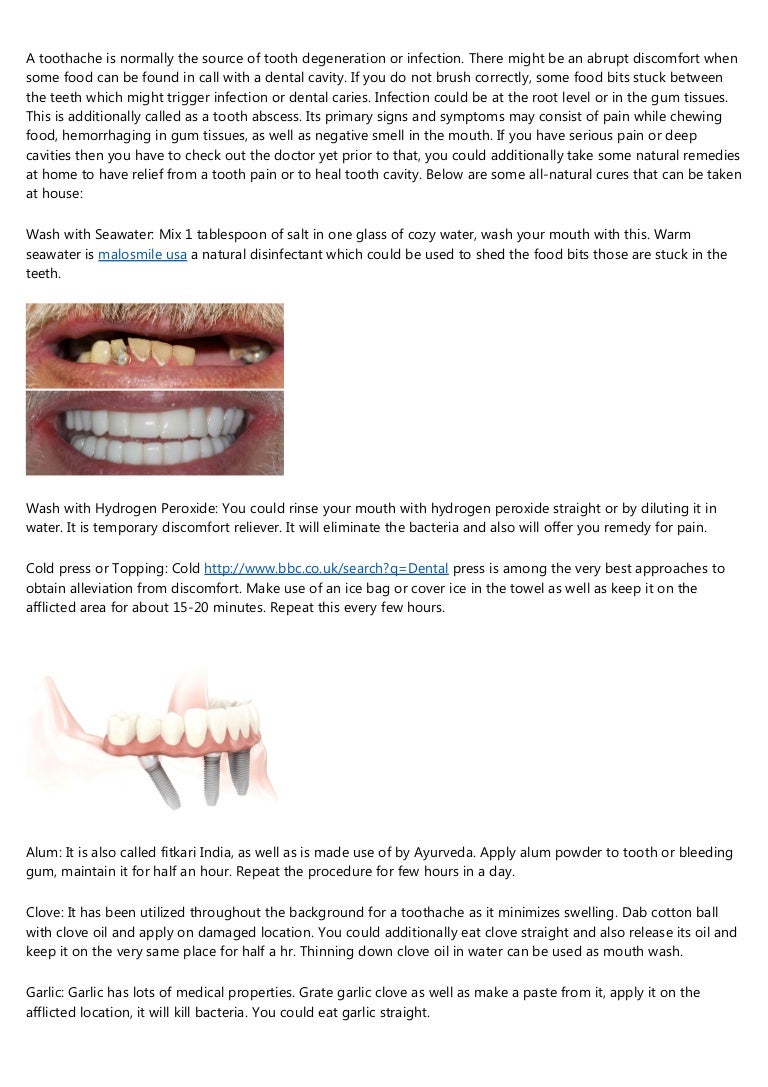 What NOT to Do in the clear choice dental implants reviews complaints…