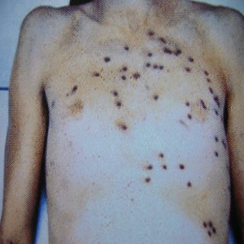 27 f wound balistics 27a