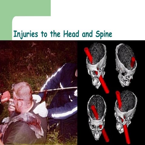 27)Injuries To The Head And Spine