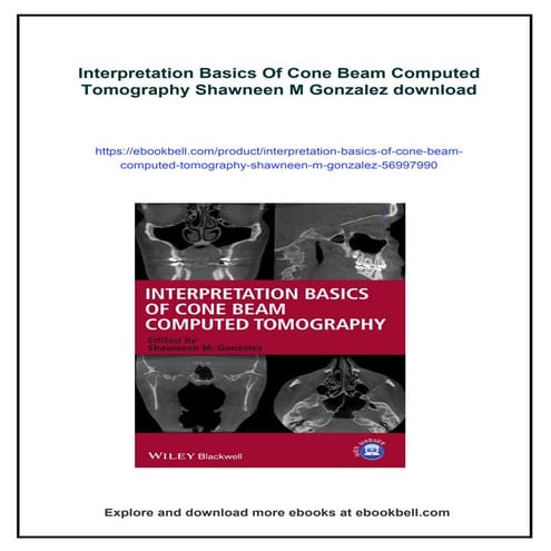 Interpretation Basics Of Cone Beam Computed Tomography Shawneen M ...