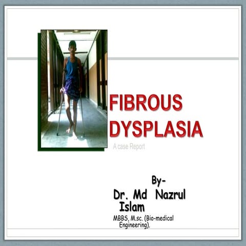FIBROUS-DYSPLASIA-CASE-PRESENTATION-At-Shaheed-Suhrawardy-Medical-College-Hos...
