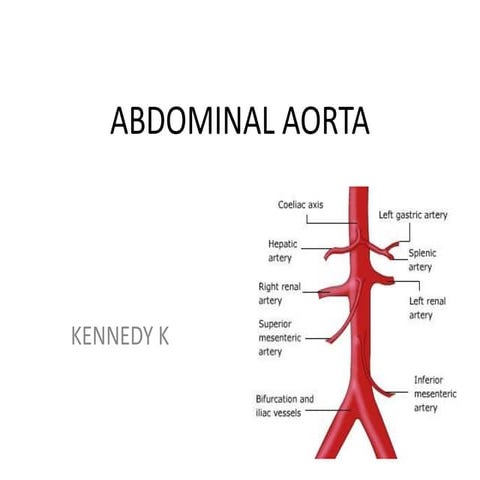 2 b. ABDOMINAL AORTA1.ppt