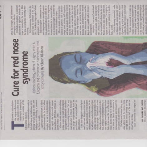 Business Times Balloon Sinuplasty