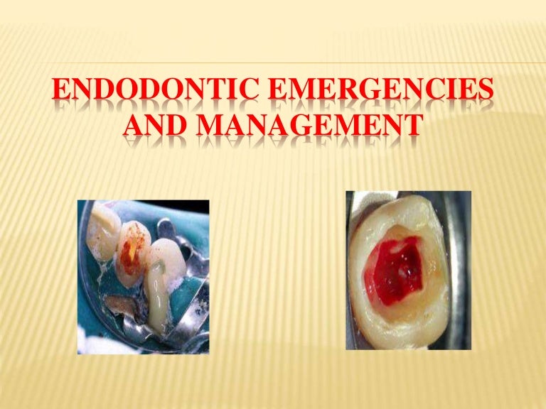 Dr. Ragi Endodontic Emergencies and Management