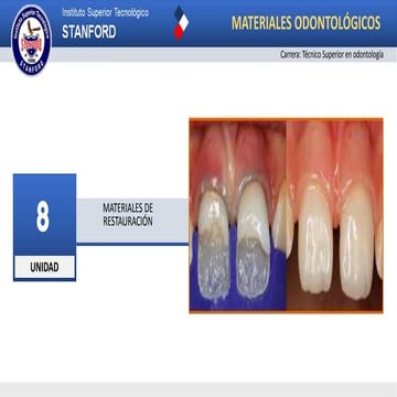 MATERIALES DE RESTAURACIÓN