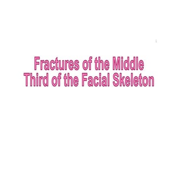 Lecture 2 maxillofacial trauma