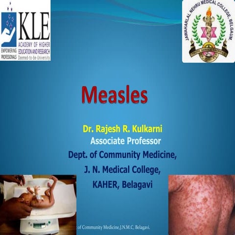 prevention and control of measles in India