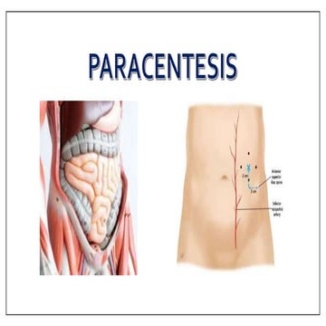 2_Paracentesis.pptx