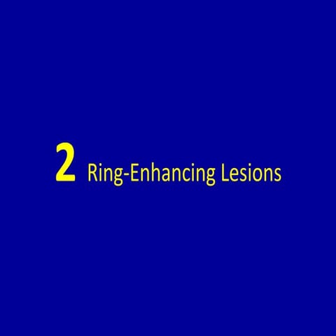 2 ring enhancing lesions