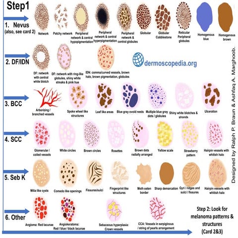 Características dermatosocpicas lesiones malignas dermoscopedia.org