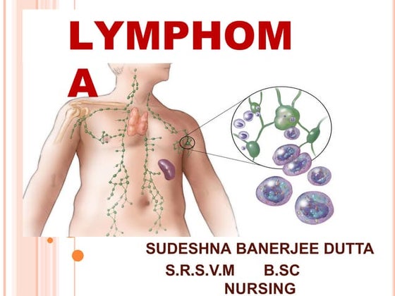 Non Hodgkin Lymphoma | PPTX