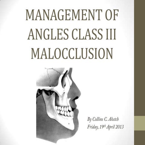 3.management of angles class iii malocclusion