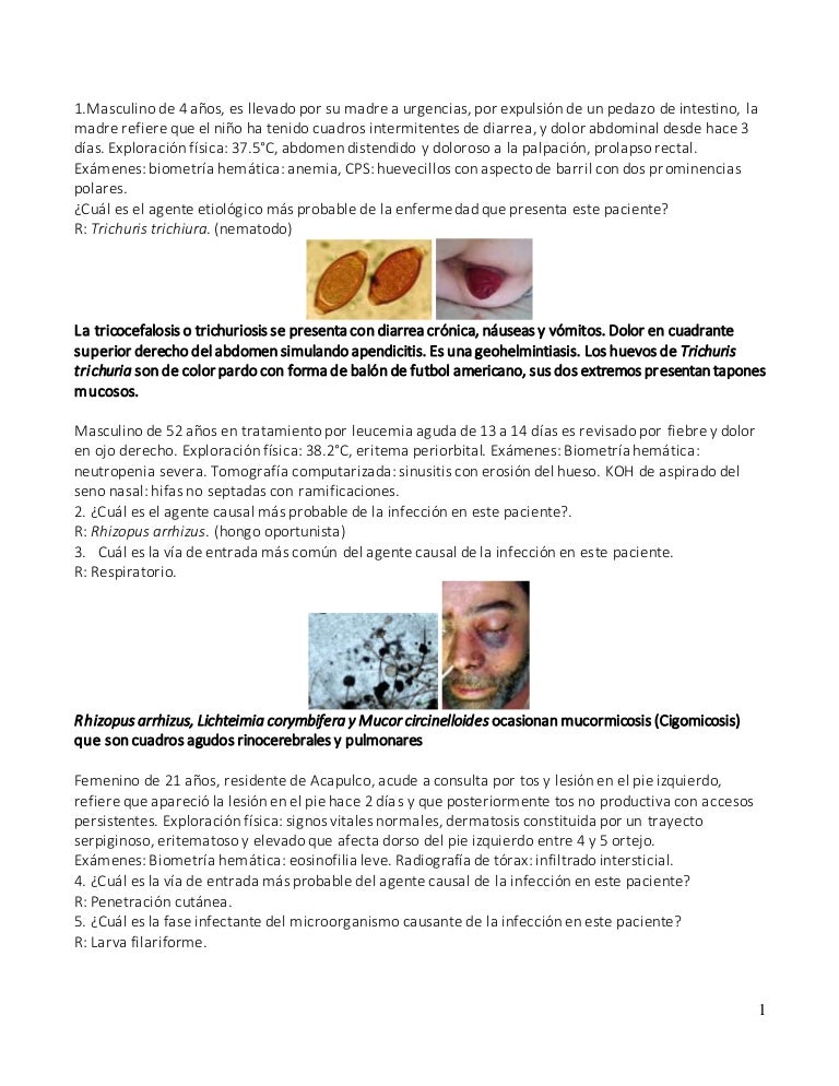 síntomas de muerte por infección de levadura sistémica síntomas de muerte por infección de levadura sistémica