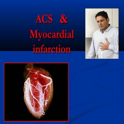 Acute Coronary Syndrome