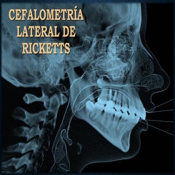 cefalometria de jarabak | PPTX