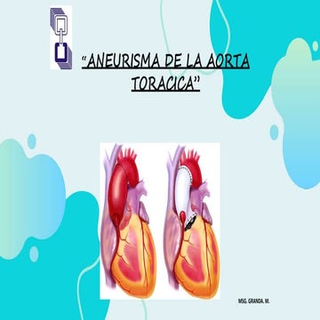 3. Aneurisma aórtico en el paciente al cuidado directo | PPTX