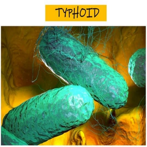Pathophysiology of Typhoid ,Its clinical manifestation, Treatment.