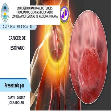 Cancer de esófago - Anatomia , clinica , tratamiento del cancer de ...