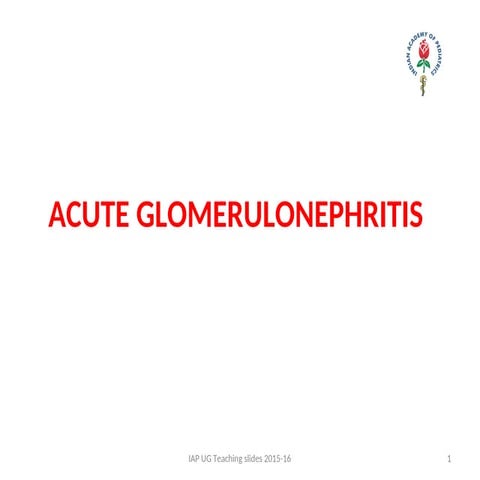 Post infectious glomerulonephritis, PIGN | PPTX