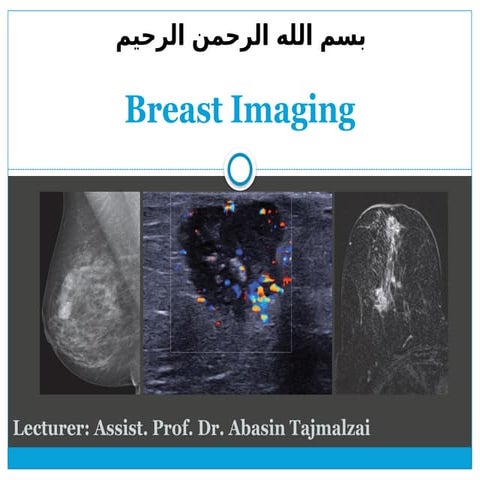 MRI BREAST PPT | PPTX