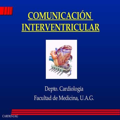 ComunicacióN Interventricular