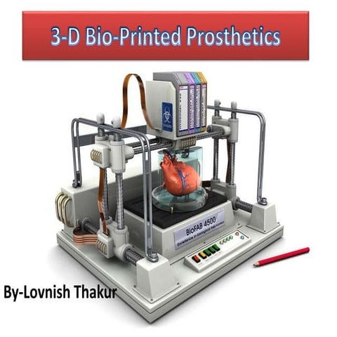 3 d printed prosthetics