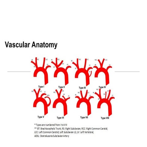 3-eke - angiographic anatomy.ppt MD STUDENT