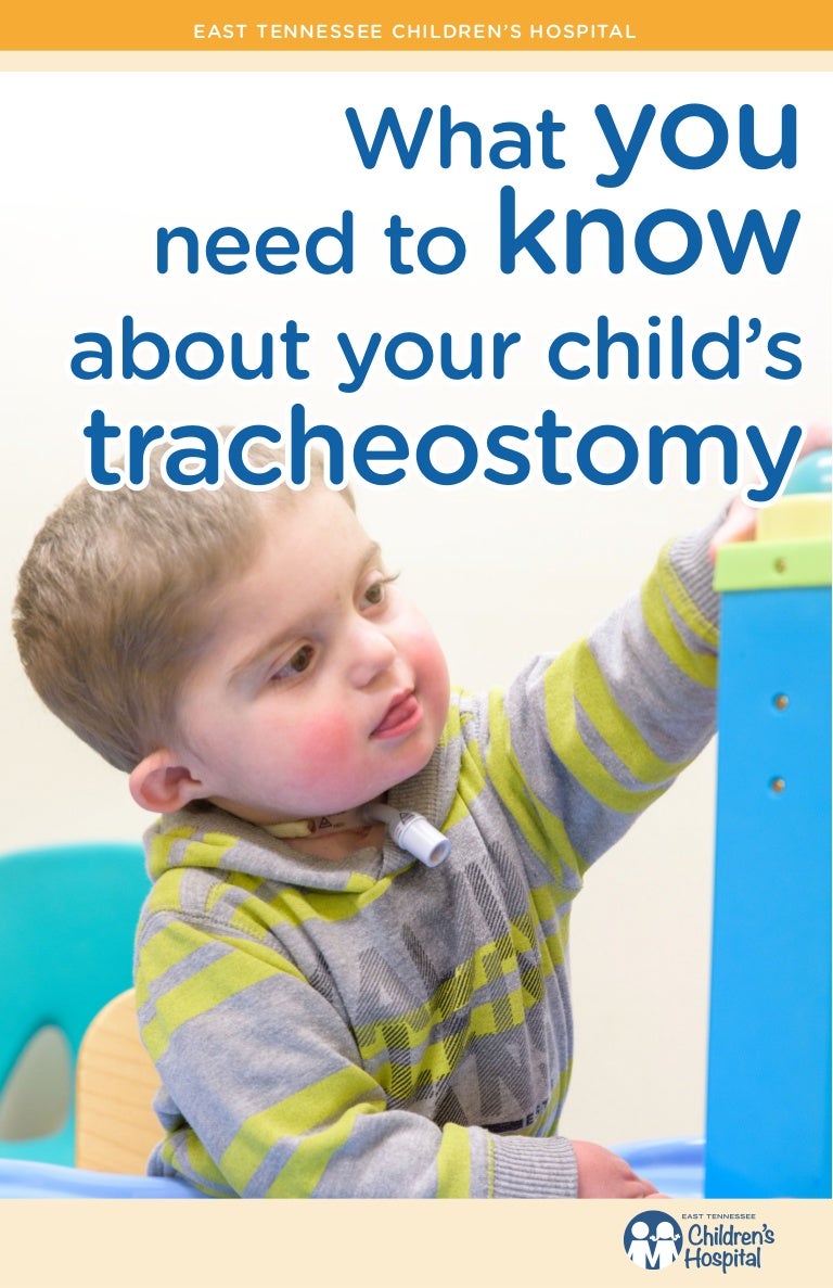 What You Need to Know About Your Child's Tracheostomy