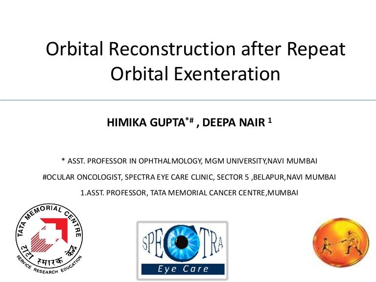 Orbital Reconstruction After Repeat Orbital Exenteration