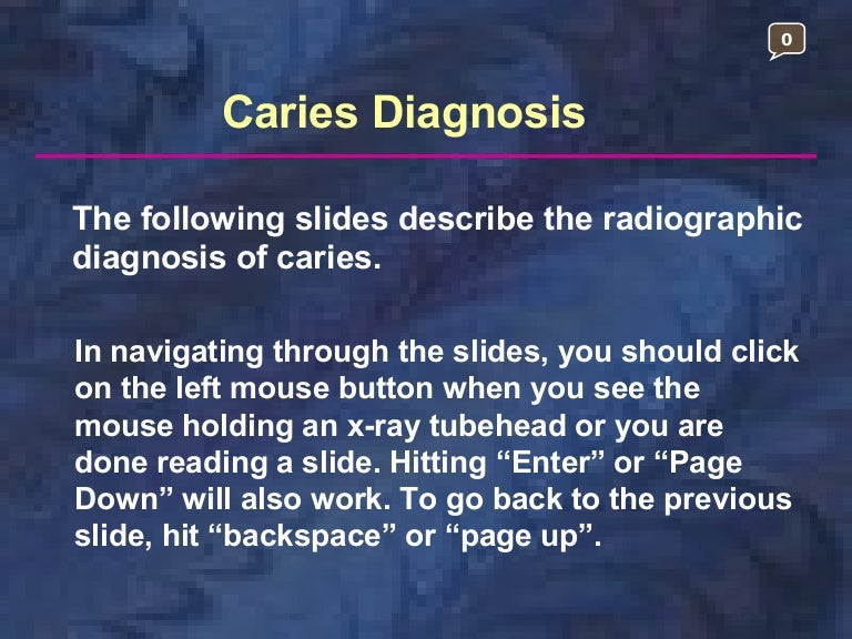 radiographic-caries-diagnosis tooth decay diagram 