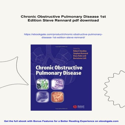 Chronic Obstructive Pulmonary Disease 1st Edition Steve Rennard | PDF