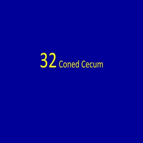 32 coned cecum | PPTX