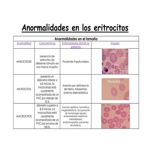 358517126-Anormalidades-en-Los-Eritrocitos.pdf