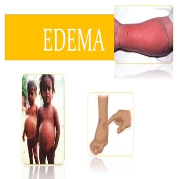 Escala edema | PDF