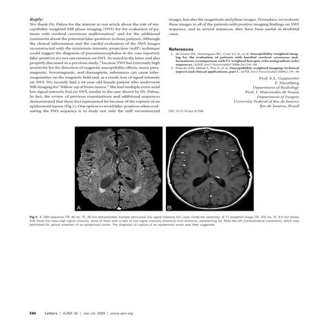 Susceptibility Weighted Imaging (SWI) | PPTX