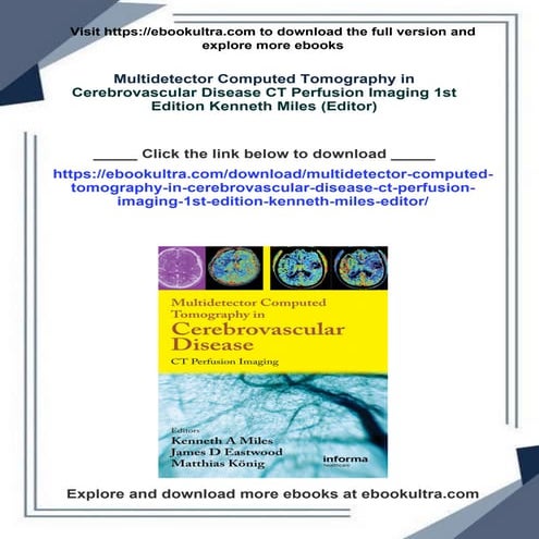 Multidetector Computed Tomography in Cerebrovascular Disease CT Perfusion Ima...
