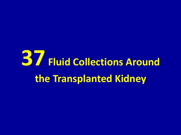37 fluid collections around the transplanted kidney