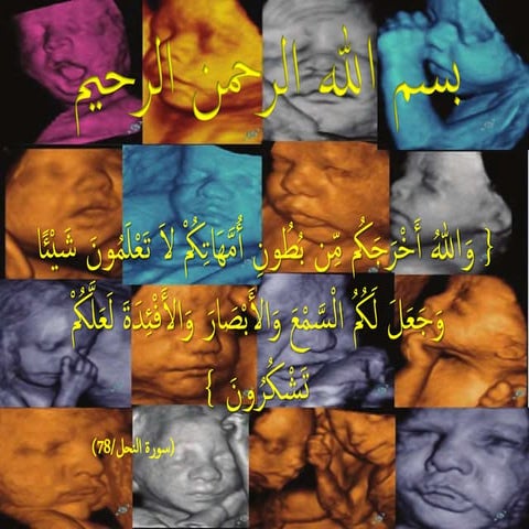 3D&4D brain anomalies 